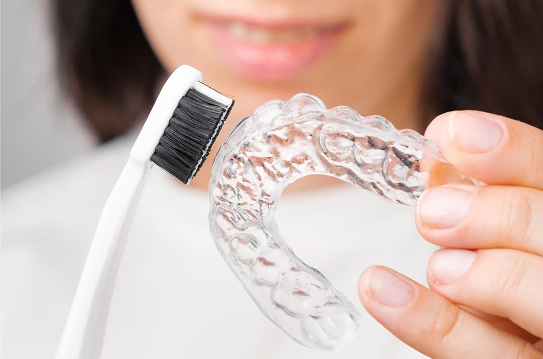 Je aligners en beugel écht fris houden? De ultieme gids voor reiniging